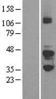 GNAZ Human Over-expression Lysates NM_002073