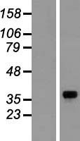 GNB1 Human Over-expression Lysates NM_002074