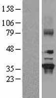 GNB2 Human Over-expression Lysates NM_005273