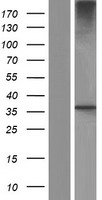 GNB3 Human Over-expression Lysates NM_002075