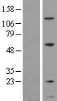 GNG5 Human Over-expression Lysates NM_005274