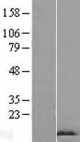 GnRH (GNRH1) Human Over-expression Lysates NM_001083111