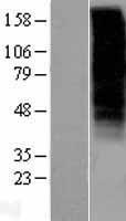 GNRHR Human Over-expression Lysates NM_000406