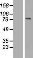 GNS Human Over-expression Lysates NM_002076