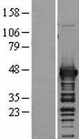 Aspartate Aminotransferase (GOT1) Human Over-expression Lysates NM_002079