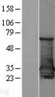 14-3-3 sigma (SFN) Human Over-expression Lysates NM_006142