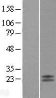 ls002815 cd42a gp9 human over expression lysates nm 000174 wb testing 1