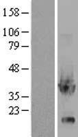 Glycerol 3 Phosphate Dehydrogenase (GPD1) Human Over-expression Lysates NM_005276