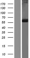 ls002821 glucose 6 phosphate isomerase gpi human over expression lysates nm 001184722 wb testing 1