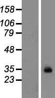 Neuronal membrane glycoprotein M6 a (GPM6A) Human Over-expression Lysates NM_201591