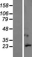 Neuronal membrane glycoprotein M6 a (GPM6A) Human Over-expression Lysates NM_201592