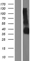 GPM6B Human Over-expression Lysates NM_001001995