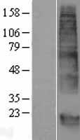 GPM6B Human Over-expression Lysates NM_001001996