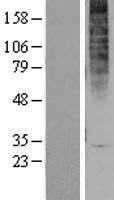 GPR1 Human Over-expression Lysates NM_005279