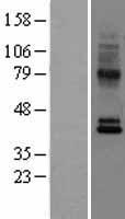 CCR10 Human Over-expression Lysates NM_016602