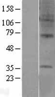 GPR6 Human Over-expression Lysates NM_005284