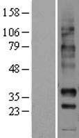 GPR7 (NPBWR1) Human Over-expression Lysates NM_005285