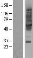 NPBWR2 Human Over-expression Lysates NM_005286