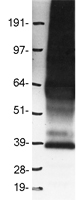 GPR10 (PRLHR) Human Over-expression Lysates NM_004248