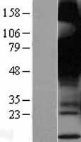 GPR12 Human Over-expression Lysates NM_005288