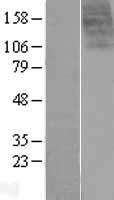 GPR14 (UTS2R) Human Over-expression Lysates NM_018949