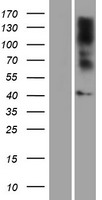 GPR17 Human Over-expression Lysates NM_005291