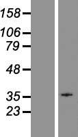 GPR18 Human Over-expression Lysates NM_001098200