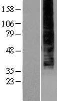 P2Y9 (LPAR4) Human Over-expression Lysates NM_005296