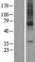 MCHR (MCHR1) Human Over-expression Lysates NM_005297
