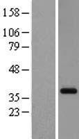 GPR26 Human Over-expression Lysates NM_153442