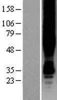 G protein coupled receptor 30 (GPER1) Human Over-expression Lysates NM_001505