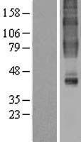 GPR32 Human Over-expression Lysates NM_001506