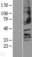 FFAR3 Human Over-expression Lysates NM_005304