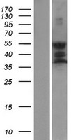 GPS2 Human Over-expression Lysates NM_004489