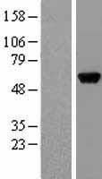 Alanine Transaminase (GPT) Human Over-expression Lysates NM_005309
