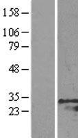 GRB2 Human Over-expression Lysates NM_002086