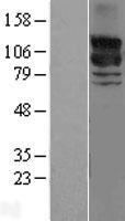 GRF2 (RAPGEF1) Human Over-expression Lysates NM_198679