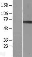 Granulin (GRN) Human Over-expression Lysates NM_002087