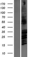 ls002904 nmdar2b grin2b human over expression lysates nm 000834 wb testing 1