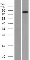 Glucocorticoid Receptor (NR3C1) Human Over-expression Lysates NM_000176