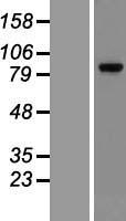 Glucocorticoid Receptor (NR3C1) Human Over-expression Lysates NM_001018074