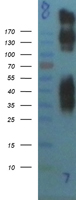 Metabotropic Glutamate Receptor 1 (GRM1) Human Over-expression Lysates NM_000838