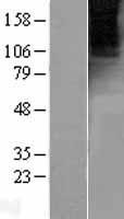 Metabotropic Glutamate Receptor 4 (GRM4) Human Over-expression Lysates NM_000841