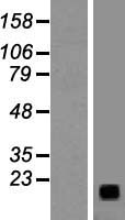 ls002922 gastrin releasing peptide grp human over expression lysates nm 002091 wb testing 1