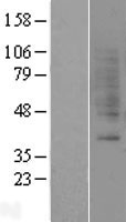 GRPR Human Over-expression Lysates NM_005314