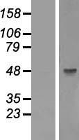GSK3 beta (GSK3B) Human Over-expression Lysates NM_002093