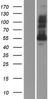 Glutathione Reductase (GSR) Human Over-expression Lysates NM_000637