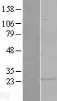 Glutathione S Transferase alpha 1 (GSTA1) Human Over-expression Lysates NM_145740