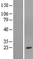 GSTM1 Human Over-expression Lysates NM_146421