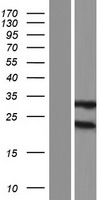 GSTM2 Human Over-expression Lysates NM_001142368